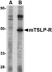 Western blot analysis of TSLP Receptor in mouse heart tissue lysate with TSLP Receptor antibody at 1 &#956;g/mL in (A) the presence and (B) the absence of blocking peptide.