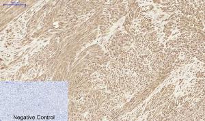 Immunohistochemical analysis of paraffin-embedded human uterus tissue using Anti-MCL1 Antibody at 1:200 (4°C overnight). Negative control was secondary antibody only.