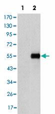 Anti-ENG Mouse Monoclonal Antibody [clone: 3A9]