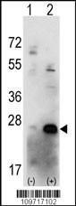 Anti-CSNK2B Rabbit polyclonal antibody