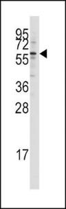 Anti-HIV-1 Tat Interacting Protein, 60kD Rabbit Polyclonal Antibody (FITC (Fluorescein))