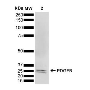 Western blot analysis of mouse brain showing detection of 2