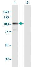 Anti-AARS Rabbit Polyclonal Antibody