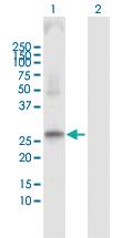 Anti-PRSS1 Rabbit Polyclonal Antibody