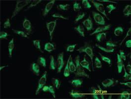 Anti-TOMM20 Mouse Monoclonal Antibody [clone: 4F3]