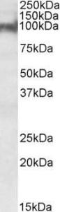 Anti-PKP2 antibody