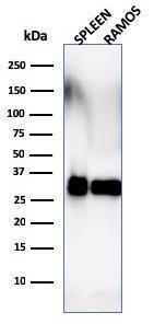 Western blot analysis of Ramos cell and human spleen tissue lysates using Anti-HLA DRB Antibody [SPM288]