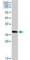 Anti-PRSS1 Rabbit Polyclonal Antibody