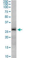 Anti-SIRT3 Goat Polyclonal Antibody