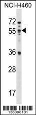 Anti-MEX3B Rabbit Polyclonal Antibody (PE (Phycoerythrin))