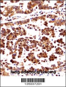 Anti-ORC3 Rabbit Polyclonal Antibody (Biotin)