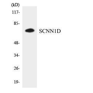 Western blot analysis of the lysates from HT 29 cells using Anti-SCNN1D Antibody