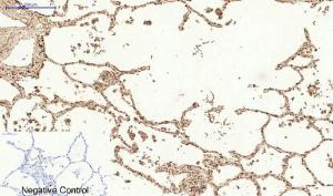 Immunohistochemical analysis of paraffin-embedded human lung tissue using Anti-MCL1 Antibody at 1:200 (4°C overnight). Negative control was secondary antibody only.