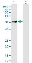 Anti-ABAT Mouse Polyclonal Antibody