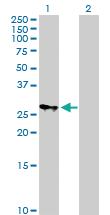 Anti-MRPS18B Mouse Polyclonal Antibody