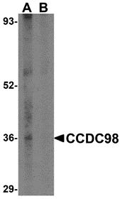 Western blot analysis of CCDC98 in human breast tissue lysate in (A) the absence and (B) presence of blocking peptide with CCDC98 antibody at 1 &#956;g/mL.