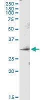 Anti-PRSS1 Rabbit Polyclonal Antibody