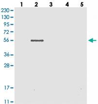 Anti-TYSND1 Rabbit Polyclonal Antibody