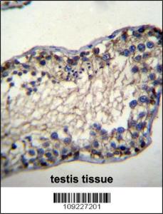 Anti-TSSK6 Rabbit Polyclonal Antibody