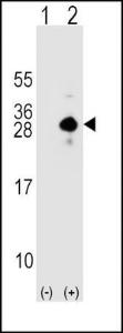 Anti-SOST Rabbit Polyclonal Antibody (HRP (Horseradish Peroxidase))