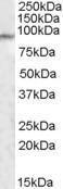 Antibody anti-MED15 100 µg