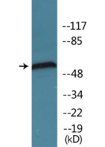 Western blot analysis of lysates from HUVEC cells treated with UV 15' using Anti-Chk1 (phospho Ser296) Antibody