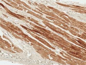 Immunohistochemistry analysis of human heart, fixed in formalin and paraffin-embedded. The Primary Antibody used was Anti-PDGF B Antibody (A304924) at 1:50 for 30 minutes at room temperature. Counterstain: Hematoxylin. Magnification: 10X. HRP-DAB Detection.