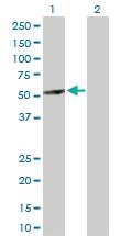 Anti-ABAT Rabbit Polyclonal Antibody