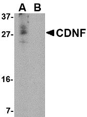 Western blot analysis of CDNF in A-20 cell lysate in (A) the absence and (B) the presence of blocking peptide. with CDNF antibody at 1 &#956;g/mL.