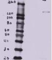 MDCK overexpressing Mouse Btbd7 (third lane) and probed with Anti-BTBD7 Antibody (A82968) (mock transfection in first lane, full construct chemically suppressed in second lane)