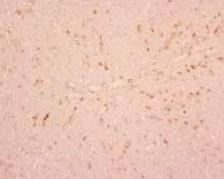 Anti-Macrophage/Monocyte Mouse Monoclonal Antibody [clone: RbM2]