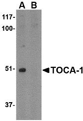 Western blot analysis of TOCA-1 in mouse brain tissue lysate with in (A) the absence and (B) the presence of blocking peptide. with TOCA-1 antibody at 1 &#956;g/mL.