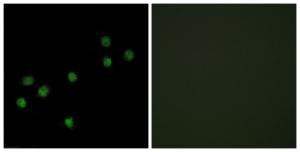 Immunofluorescence analysis of HepG2 cells using Anti-Centromeric Protein A Antibody. The right hand panel represents a negative control, where the antibody was pre-incubated with the immunising peptide.