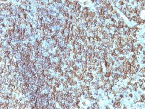 Immunohistochemical analysis of formalin-fixed, paraffin-embedded human tonsil using Anti-HLA DRB Antibody [SPM288]