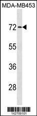 Anti-MEX3C Rabbit Polyclonal Antibody (FITC (Fluorescein Isothiocyanate))