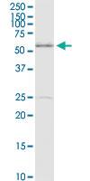 Anti-MDM4 Rabbit Polyclonal Antibody