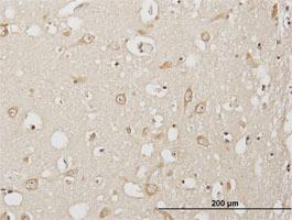 Anti-USP3 Mouse Polyclonal Antibody