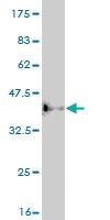 Anti-ASCL1 Mouse Monoclonal Antibody [clone: 1C5]