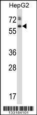 Anti-ASPG Rabbit Polyclonal Antibody (Biotin)