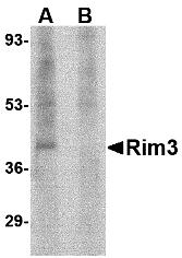 Western blot analysis of Rim3 in human brain tissue lysate with Rim3 antibody at 1 &#956;g/mL in the (A) absence and (B) presence of blocking peptide.