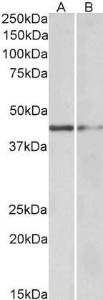 Anti-GATA3 Antibody (A82969) (05 µg/ml) staining of Human Tonsil (A) and Mouse Kidney (B) lysate (35 µg protein in RIPA buffer) Primary incubation was 1 hour Detected by chemiluminescence