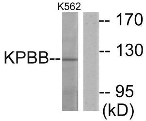 Western blot analysis of lysates from K562 cells using Anti-KPBB Antibody. The right hand lane represents a negative control, where the antibody is blocked by the immunising peptide.