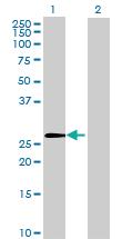 Anti-ZNF771 Mouse Polyclonal Antibody