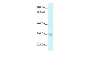 Anti-SRA1 Rabbit Polyclonal Antibody