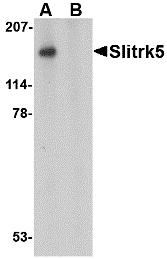 Western blot analysis of Slitrk5 in 3T3 cell lysate with Slitrk5 antibody at 1 &#956;g/mL in the (A) absence or (B) presence of blocking peptide.