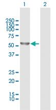 Anti-DYNC1LI2 Rabbit Polyclonal Antibody