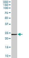 Anti-TIRAP Goat Polyclonal Antibody