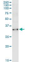 Anti-TCEA2 Polyclonal Antibody Pair