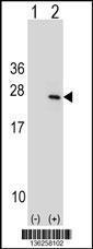 Anti-PTP4A1 Rabbit Polyclonal Antibody