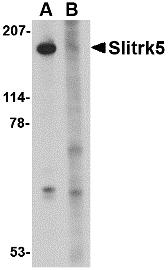 Western blot analysis of Slitrk5 in 3T3 cell lysate with Slitrk5 antibody at 1 &#956;g/mL in the (A) absence or (B) presence of blocking peptide.